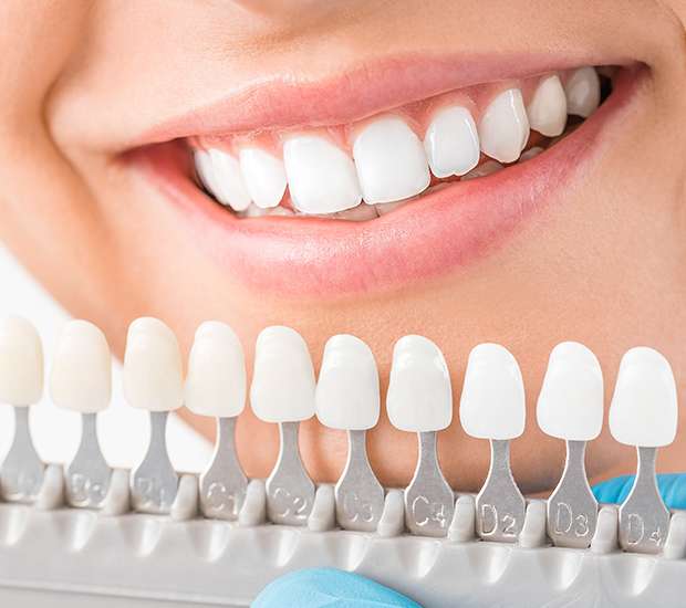 Port Saint Lucie Cosmetic Dentist