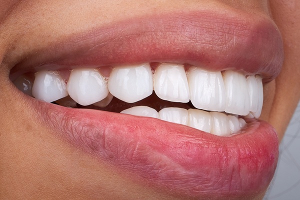 Three Benefits Of Dental Bonding