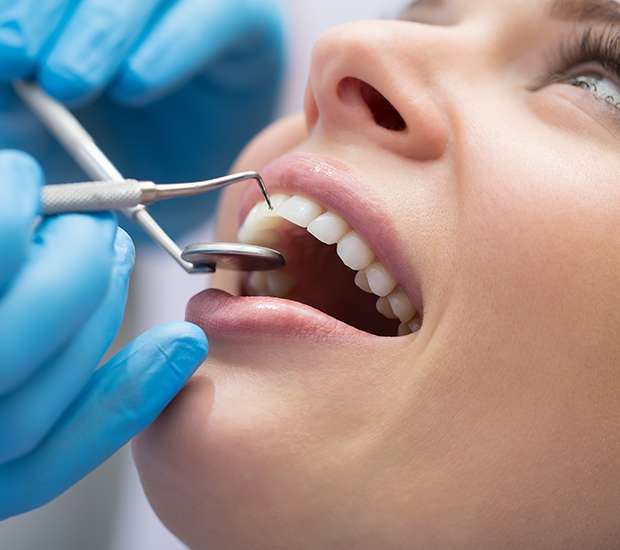Port Saint Lucie Dental Bonding