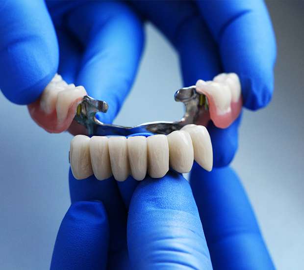 Port Saint Lucie Dental Bridges