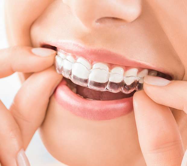 Port Saint Lucie Does Invisalign Really Work