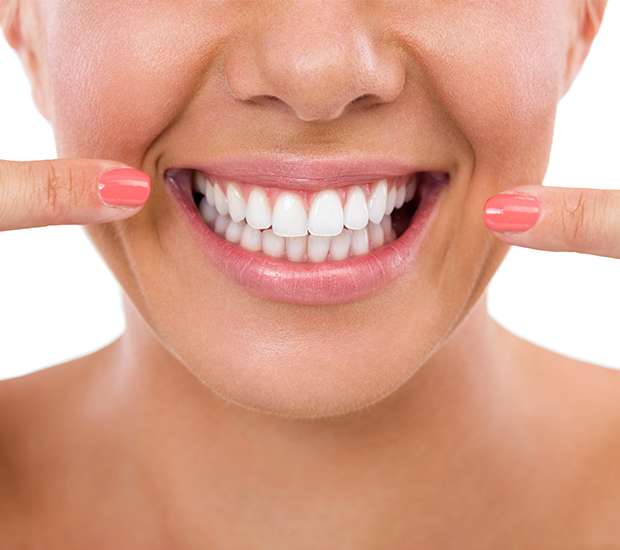 Port Saint Lucie What Is Gum Contouring and Reshaping