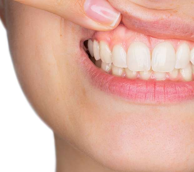 Port Saint Lucie Gum Disease