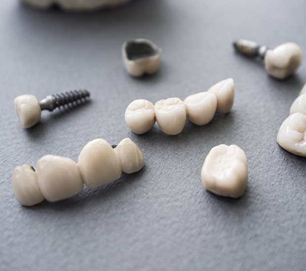 Port Saint Lucie The Difference Between Dental Implants and Mini Dental Implants