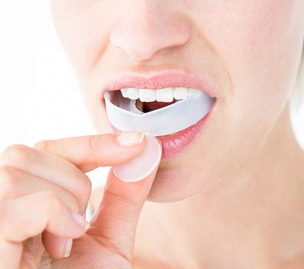 Port Saint Lucie Mouth Guards