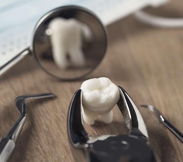 Port Saint Lucie When Is a Tooth Extraction Necessary